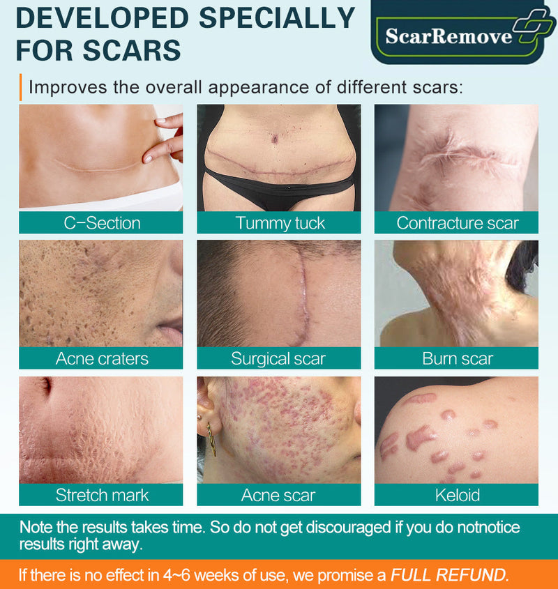 🔥ÚLTIMO DÍA 70% DE DESCUENTO❤️ScarRemove Advanced Scar Spray para todo tipo de cicatrices