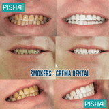 Smokers - Despidete de las manchas en tus dientes😁🦷