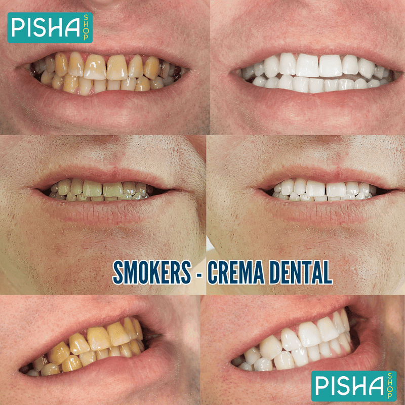 Smokers - Despidete de las manchas en tus dientes😁🦷