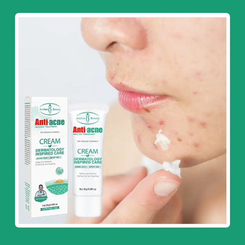 Crema anti acné DERMATOLÓGICA-¡Renueva tu Piel, dile adiós al acné!✨